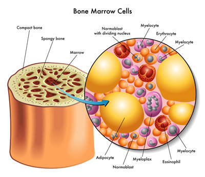 Bone Marrow Biopsy