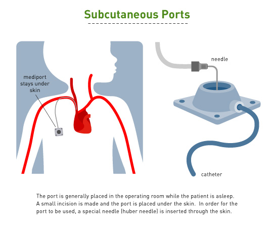 Chemotherapy-Web2