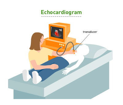 Echocardiogram