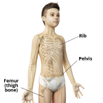 Ewing Sarcoma