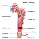 Osteosarcoma