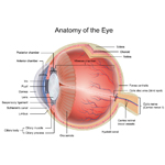 Retinoblastoma