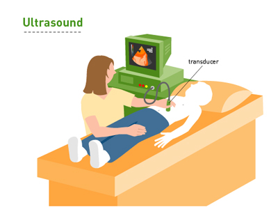 Ultrasound